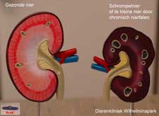 een goede en een slechte nier = schrompelnier